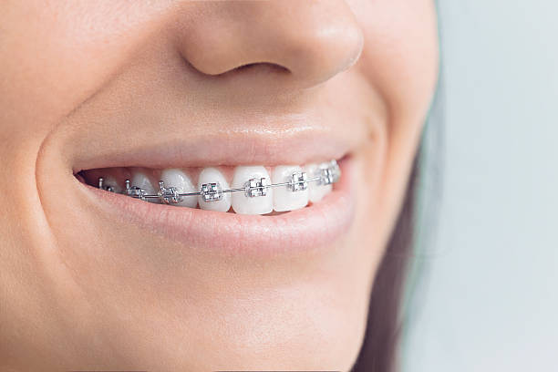 Best Invisalign and Clear Aligners  in Keyes, CA